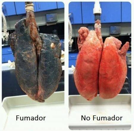 Fumador-pulmones.jpg