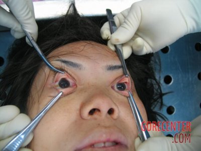 Detailed-autopsy-of-Chinese-woman-7.jpg