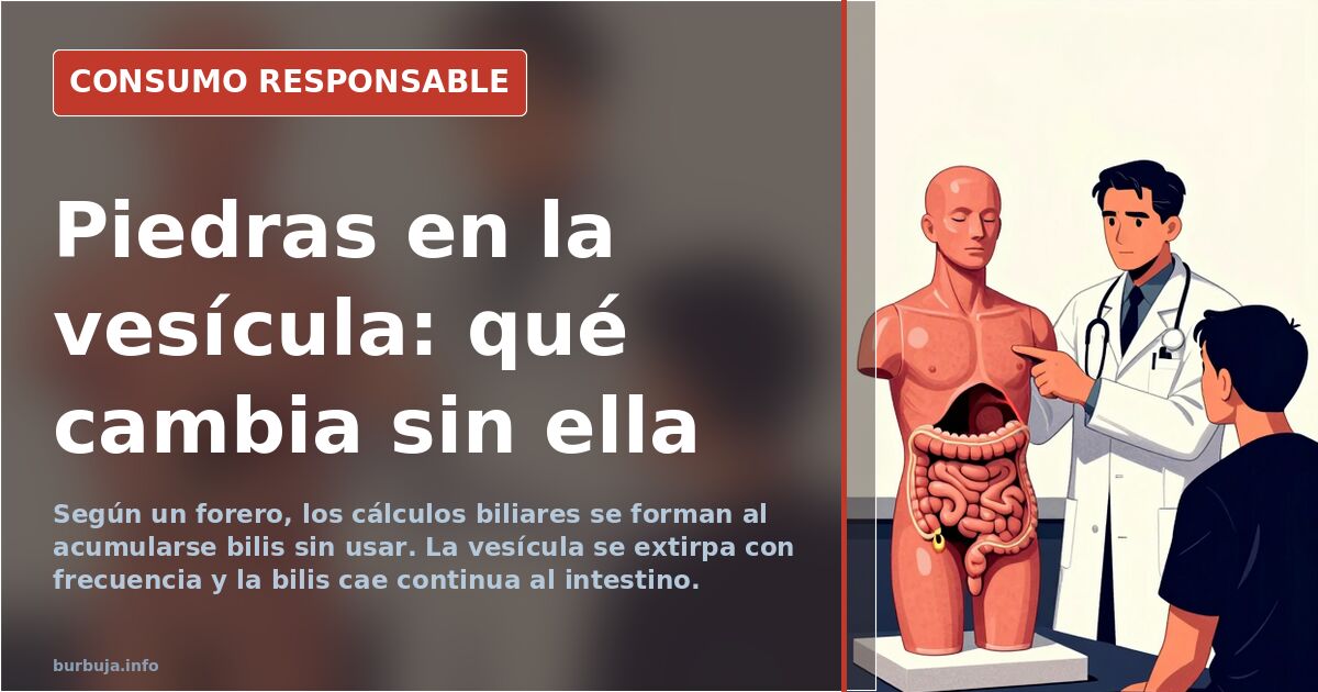 Cólicos biliares: por qué se operan las piedras de la vesícula