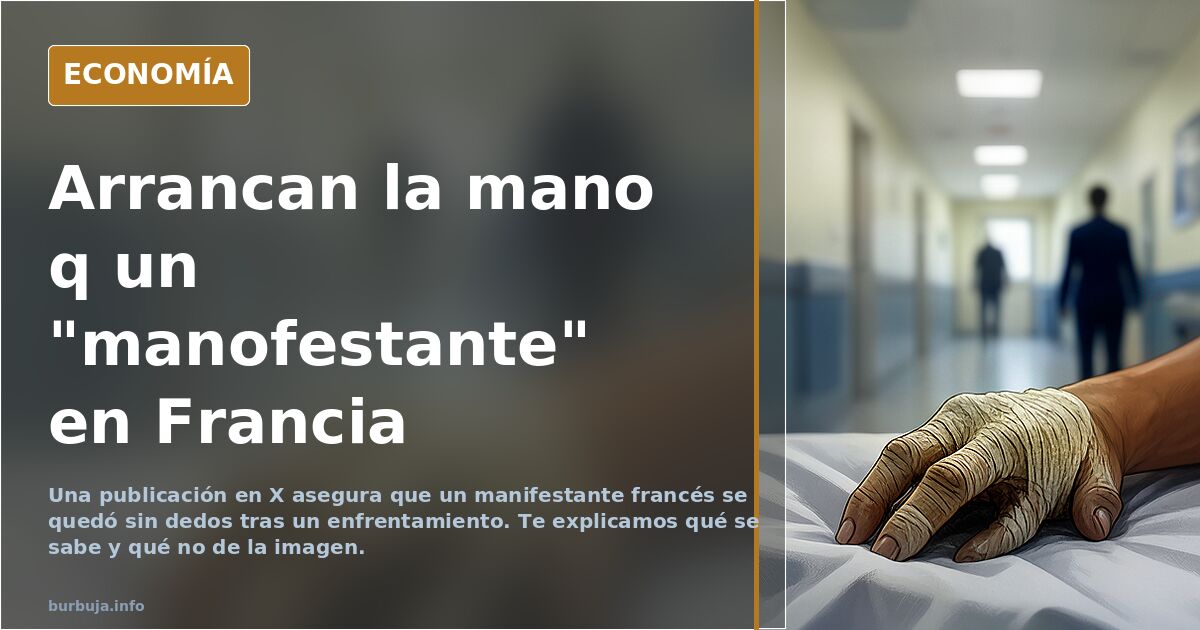 Arrancan la mano q un "manofestante" en Francia