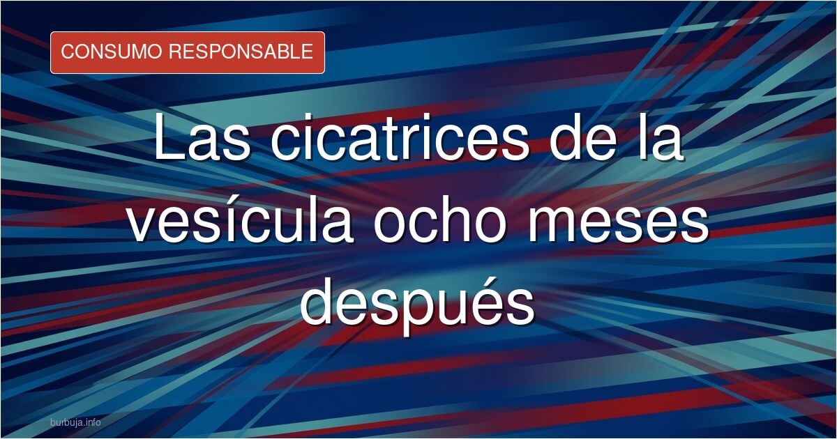 Cicatrices abdominales tras una operación de vesícula biliar