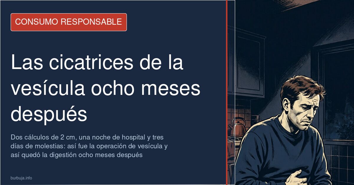 Operación de vesícula: cicatrices y dudas ocho meses después