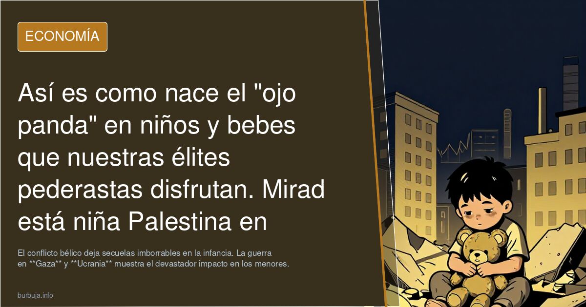 Así es como nace el "ojo panda" en niños y bebes que nuestras élites *******astas disfrutan. Mirad está niña Palestina en shock . Ellos o nosotros